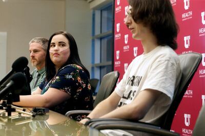 Aubree Butterfield listens as Alexander Mitchell during a press conference at the University of Utah Hospital in Salt Lake City on Tuesday, Aug. 6, 2019. Both Butterfield and Mitchell were treated for lipoid pneumonia linked to vaping,