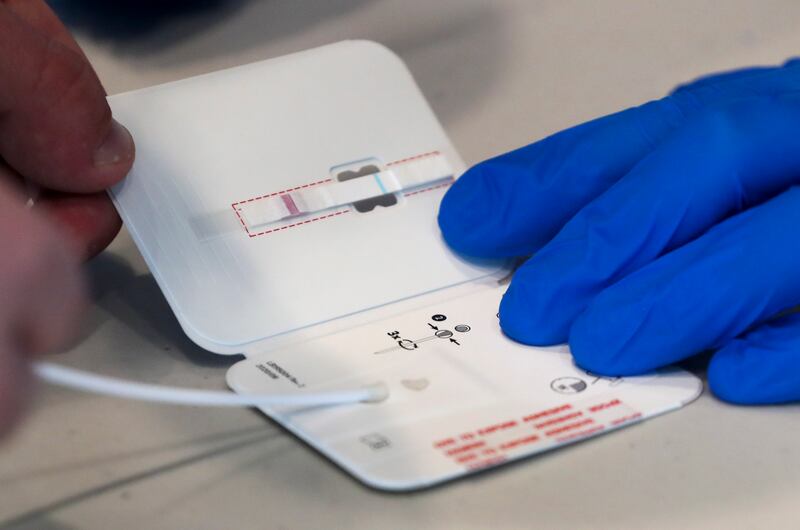 A University of Utah student places a swab in a rapid COVID-19 test.