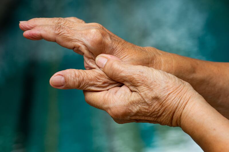 The left hand of a senior woman with arthritis massages the thumb of her right hand.