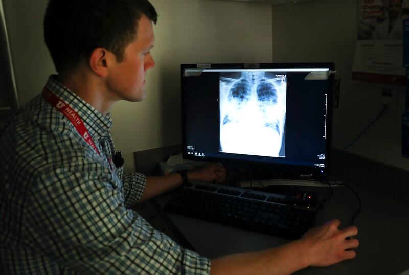 Dr. Sean Callahan, assistant professor of Pulmonary and Critical Care Medicine, looks over an X-ray of a lung injury