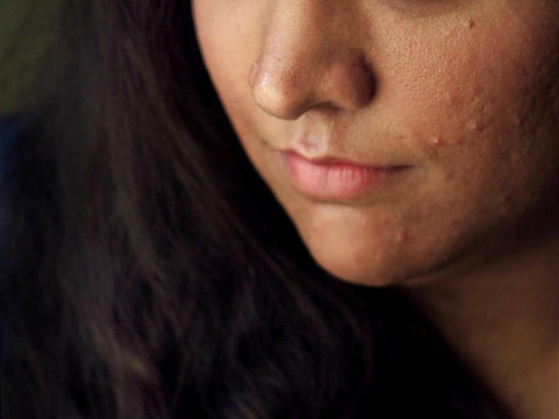 Birpal Kaur is a Sikh woman who struggles to maintain kesh, which in the Sikh faith means she keeps all her hair (head and body). Sikh women increasingly stop observing this practice as modern standards of beauty have become more prevalent .