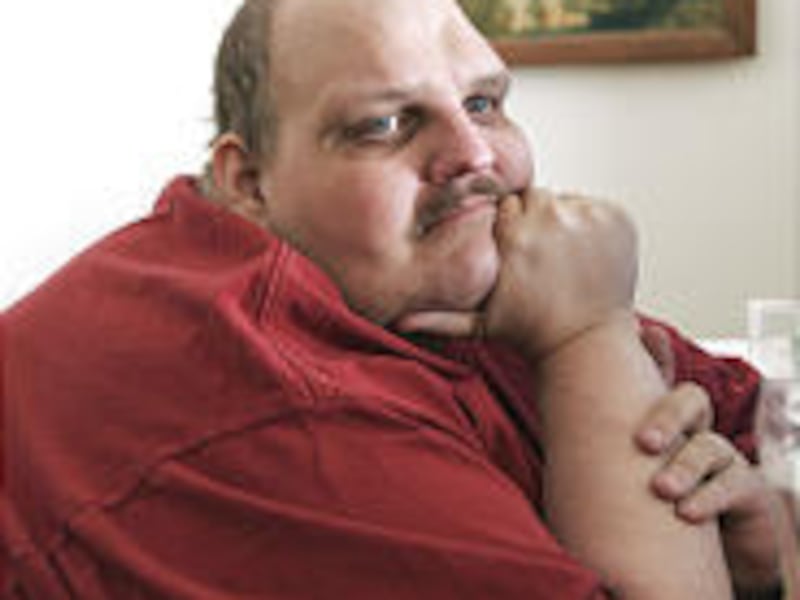 Patrick Deuel weighed 1,072 lbs. before gastric bypass. He's lost 573.