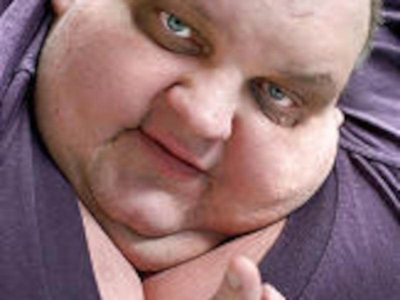 Patrick Deuel, 42, before he lost 421 pounds leading up to Wednesday's gastric bypass surgery.