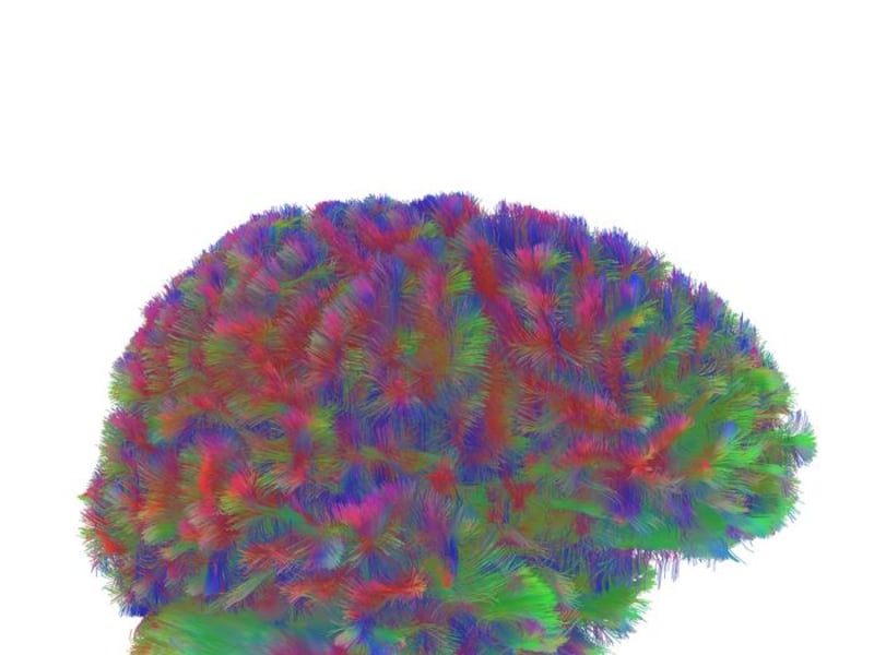 A representative MRI tractography image of the first era of the human brain. The image is representative of the general pattern seen across the brains during the first era of neural wiring, between birth and age 9.