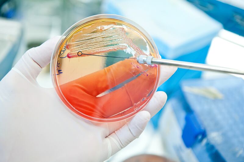 A petri dish is shown with cultures inside.