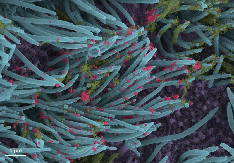 A higher power magnification image shows the structure and density of SARS-CoV-2.