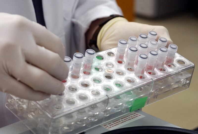 Vials containing mosquitoes, which were caught last week in Albany, Ga., are assessed in the Wildlife Health building on the university campus in Athens, Ga.