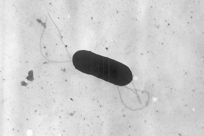 A Listeria monocytogenes bacterium.