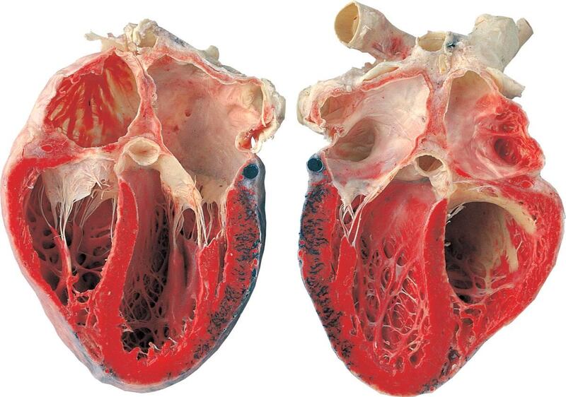 Heart, opened longitudinally.