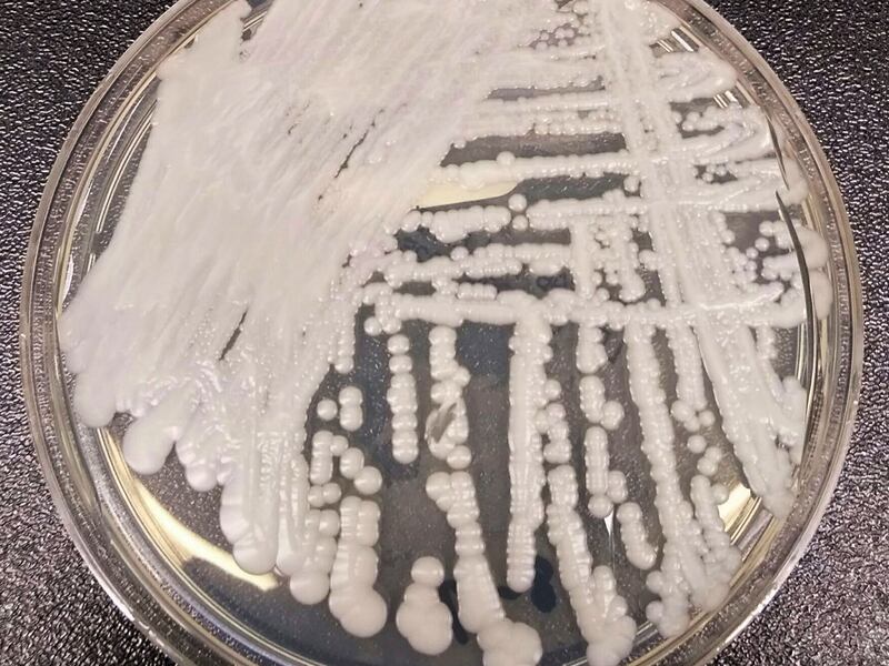 A strain of Candida auris cultured in a petri dish at a CDC laboratory.
