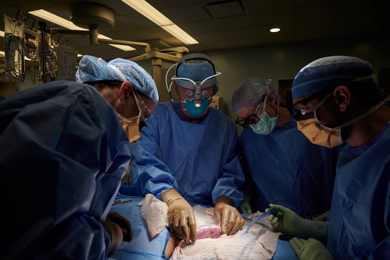 A surgical team examines a pig kidney attached to the body of a deceased recipient for any signs of rejection.