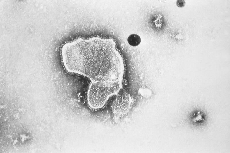 An electron microscope image shows a human respiratory syncytial virus, also known as RSV.